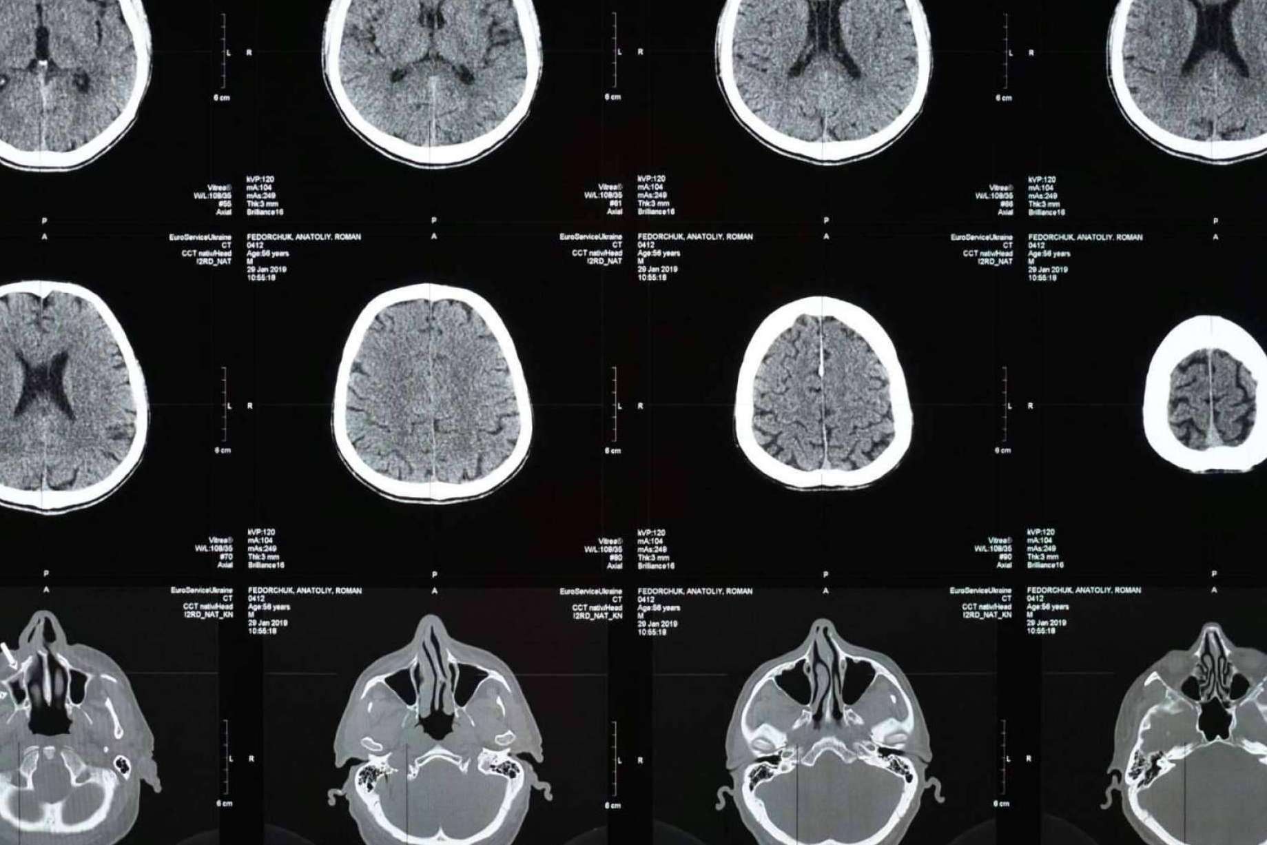 New Screening Tool Enhances Early Detection of Mental Health Disorders in Children